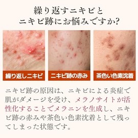 Dr. Re9 (Medicinal Use) Belblanc W+ Highly Penetrating Whitening Beauty Essence (Acne Marks, Redness, Irregularities, Pigmentation, Roughness, Skin Roughness, Care), Tranexamic Acid, 6 Vitamins