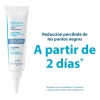 Crema Facial Ducray Keracnyl Glycolic Puntos Negros Espinillas