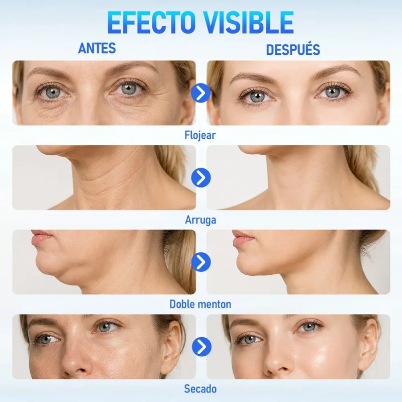 2pcs 20% Ácido Azelaico Crema Con Vitamina C Y Niacinamida