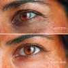 Contorno de Ojos en Gel Anti-Ojeras, Bolsas y Arrugas |