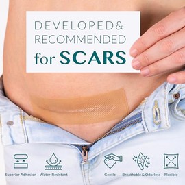 Cinta de silicona para cicatrices, láminas de silicona para cicatrices, cinta para cicatrices quirúrgicas, cinta de silicona para cicatrices, láminas para cicatrices quirúrgicas, cesárea, abdomi