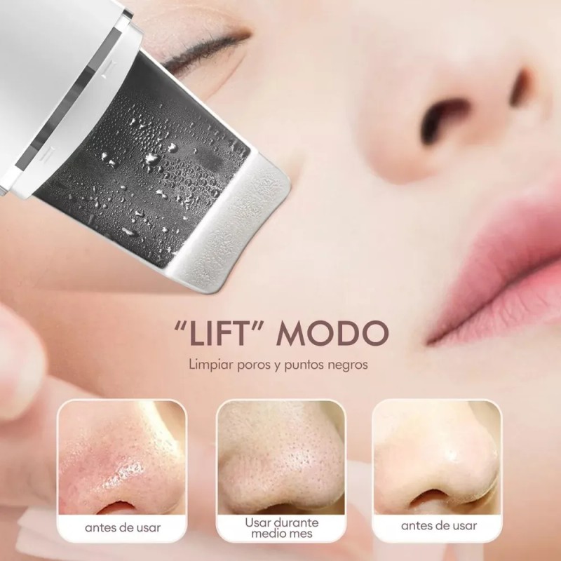 Limpiador Facial Ultrasónico Exfoliante Espinillas Belleza Blanco