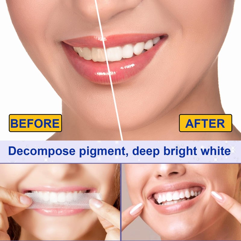 Teeth Whitening Strips Bleaching Teeth, Whitening Teeth Strips, Effective and