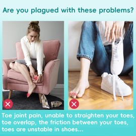 Byehambuni Hammer Toe Straightener, 6 Pack Hammer Toe Corrector for Women, Gel Toe Straighteners for Curled, Crooked, Bent, Claw, Hammertoe for Women and Men, Large Size (Beige)