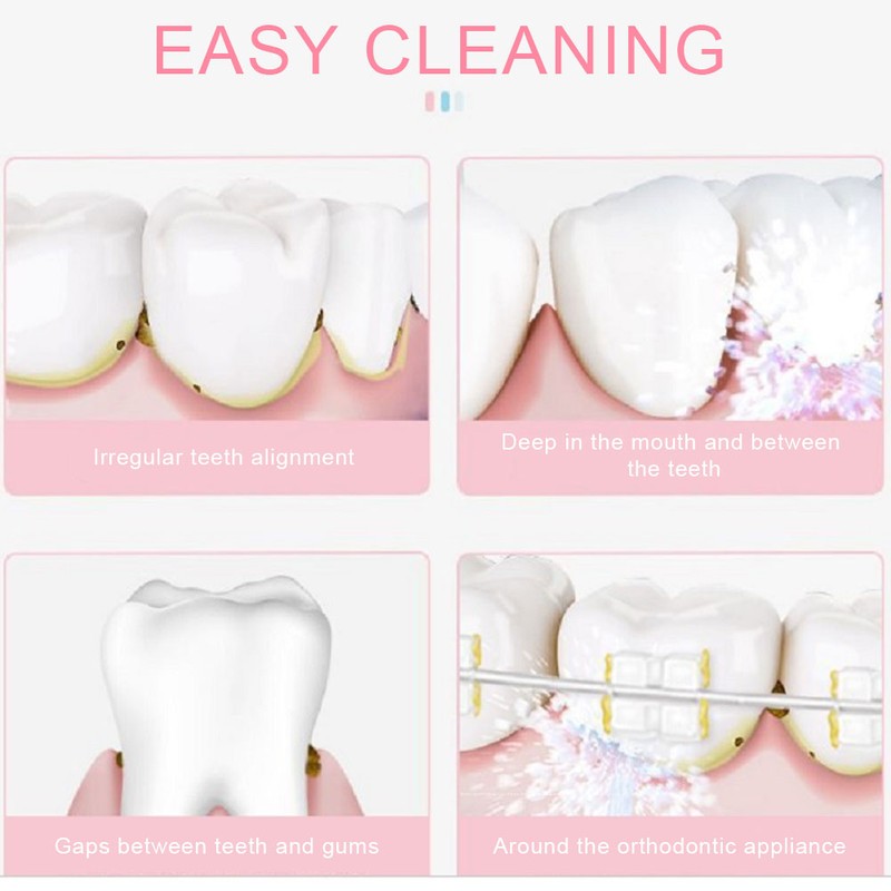 Electric Oral Irrigator Water Flosser Portable USB Charging Home Teeth