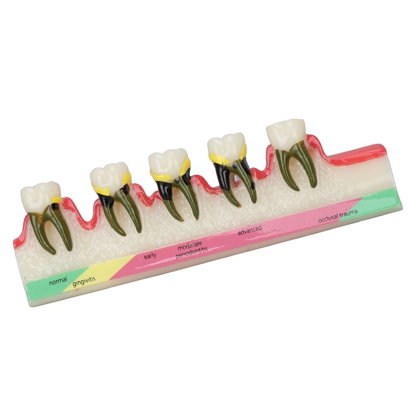 Dental Teeth Model Ceramic Clear Structure Oral Care Educational Periodontal
