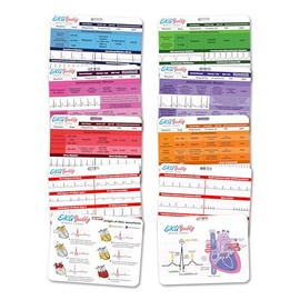 EKG Buddy's - Juego de 5 tarjetas de interpretación de ECG - Hoja de trucos de doble cara para enfermera, hoja de trucos de ritmo, tiras de telemetría de EKG para referencia médica cardíaca y