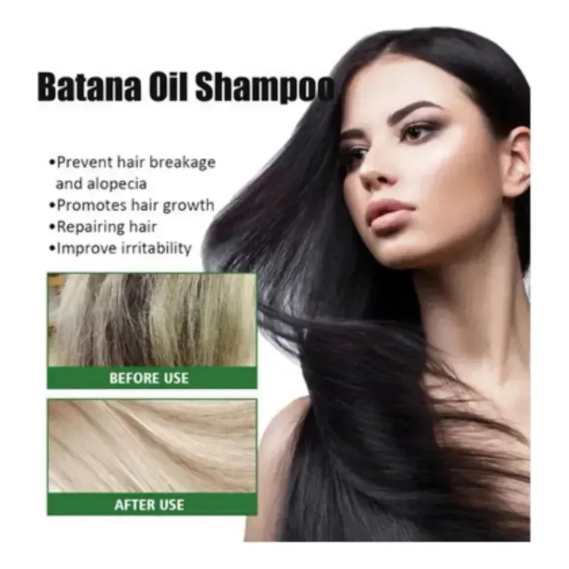 Batana Oil Shampoo, Shampoo De Batana, Rosemary Oil Shampoo