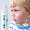 BRIOTECH BRIOTECH Hypochlorous Acid Spray, Topical Skin Face & Body