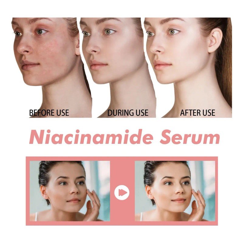 Ho Serum Niacinamida, Aclarante Reduce Poros Hidratante