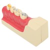 Right Lower Posterior Tooth Model 2X Magnification Detachable Resin Tooth