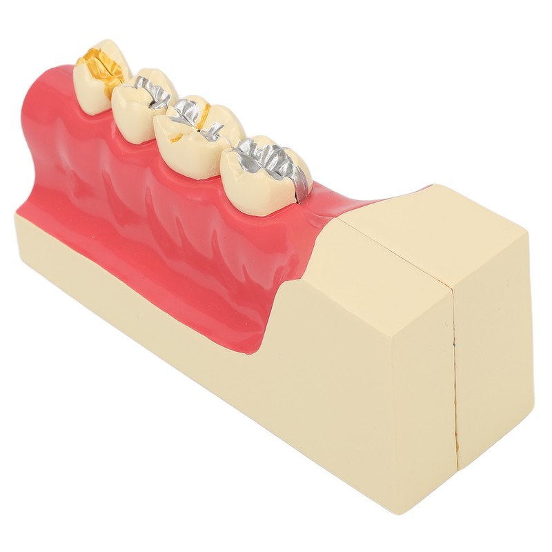 Right Lower Posterior Tooth Model 2X Magnification Detachable Resin Tooth