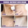 ARCHIDATE Snail Oil Ointment Moisturising Neck Cream Skin Care