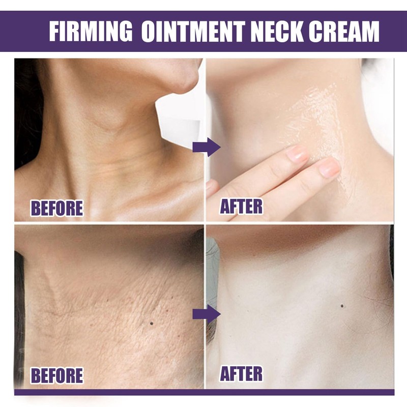 ARCHIDATE Snail Oil Ointment Moisturising Neck Cream Skin Care