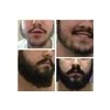 Crecer Barba Bigote Profesional Y Natural Novocrin