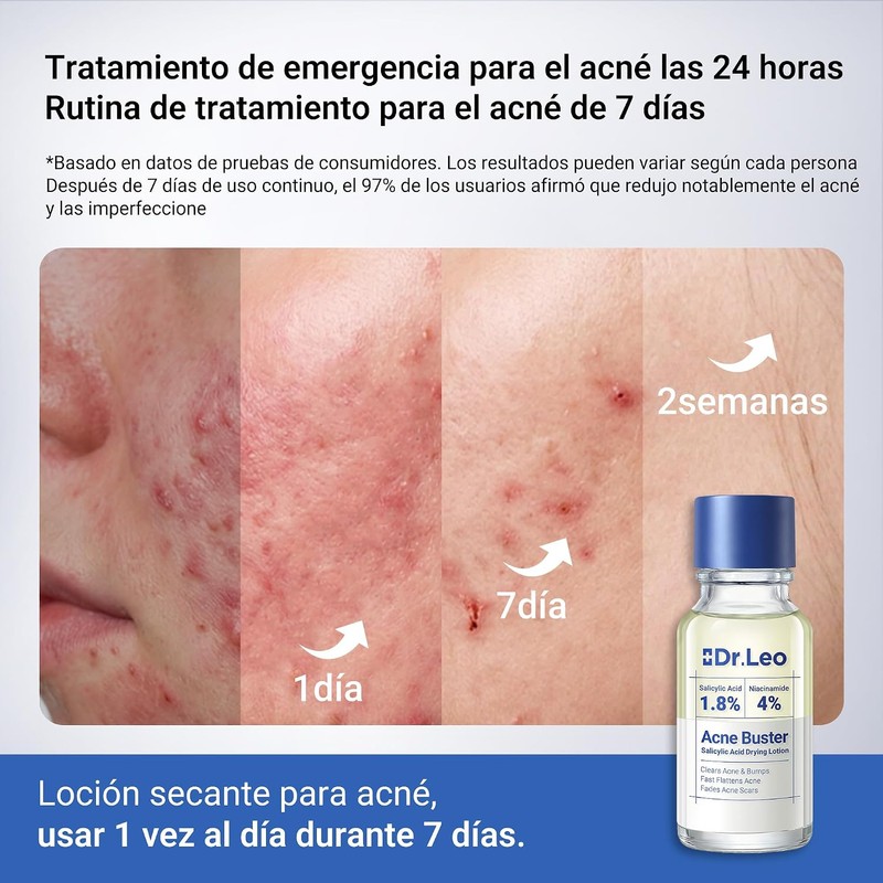 Dr.Leo Loción Secante Antiacné, Ácido Salicílico 1.8% y Niacinamida, 20