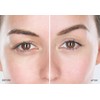 Transformulas FaceFixers Eyelifting in a Tube, Instant Eye and Brow