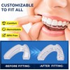 Mouth Guard for Grinding Teeth at Night: Moldable Dental Guard