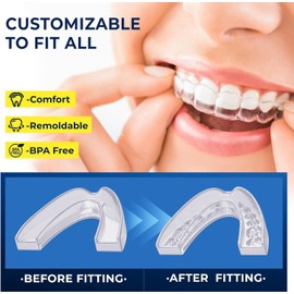 Mouth Guard for Grinding Teeth at Night: Moldable Dental Guard for Sleeping - Nighttime Protection for Teeth (4 Counts)