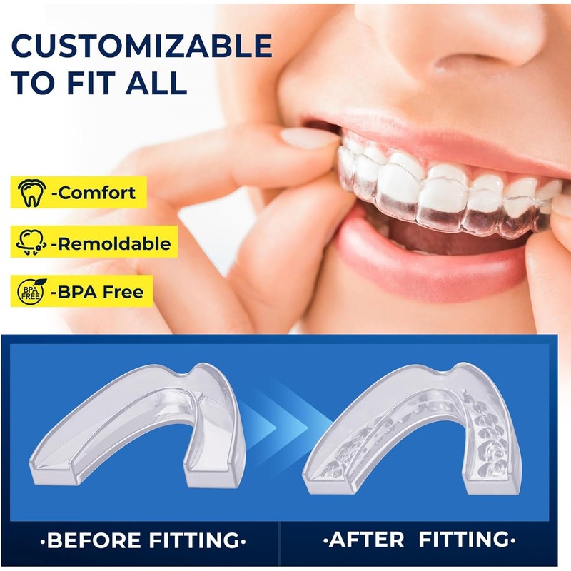 Mouth Guard for Grinding Teeth at Night: Moldable Dental Guard