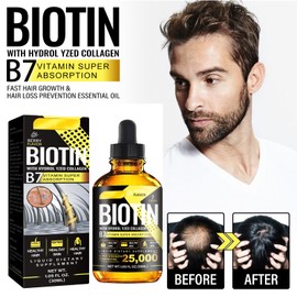 Hair Growth Serum, Fast Growing Hair Serum, Liquid for Hair Growth, Serum for Hair Loss, Serum for Hair Regrowth, Serum for Hair Growth, 1 Piece