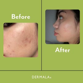 Dermala SCANTILY Pad® - type: 00860475001144