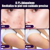 3 Gel Facial Anti-piel Acne Con Adapalene Para Piel Acnes