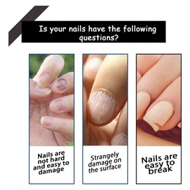 Nail Growth & Repair Serum – Strengthener & Hardener for Damaged Nails. Promotes Healthy Growth, Restores Strength, and Protects Weak, Brittle Nails. Fast-Acting Formula for Stronger, Beautiful Nails