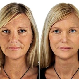 Crema suero antiarrugas con retinol + colágeno, ácido hialurónico, vitamina C 4 oz