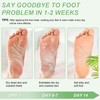 Foot Peel Masks, 5 Pairs Feet Exfoliating Socks, Aloe Vera