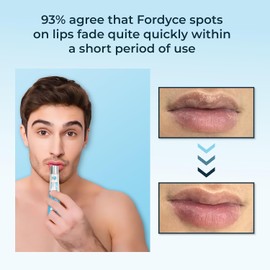 Crema Para Labios Hvsun Contra El Acné - Semillas De Fordyce Hidrata Y Mejora La Sequedad Y El Agrietamiento De Los Labios - 20 Ml