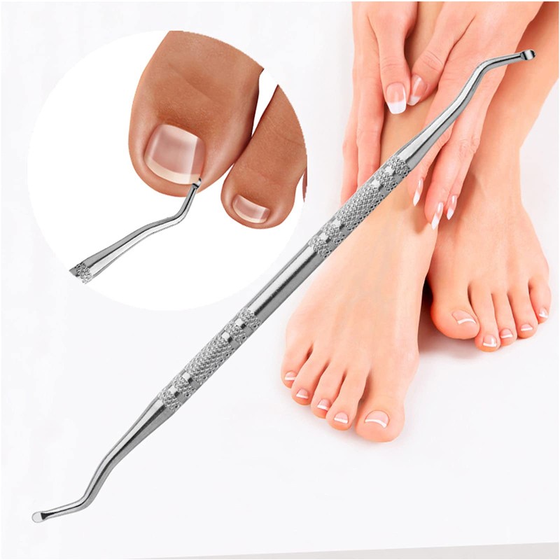 (30+2) Pack Ingrown Toenail Correction Treatment Kit, 30PCS Ingrown Toenails