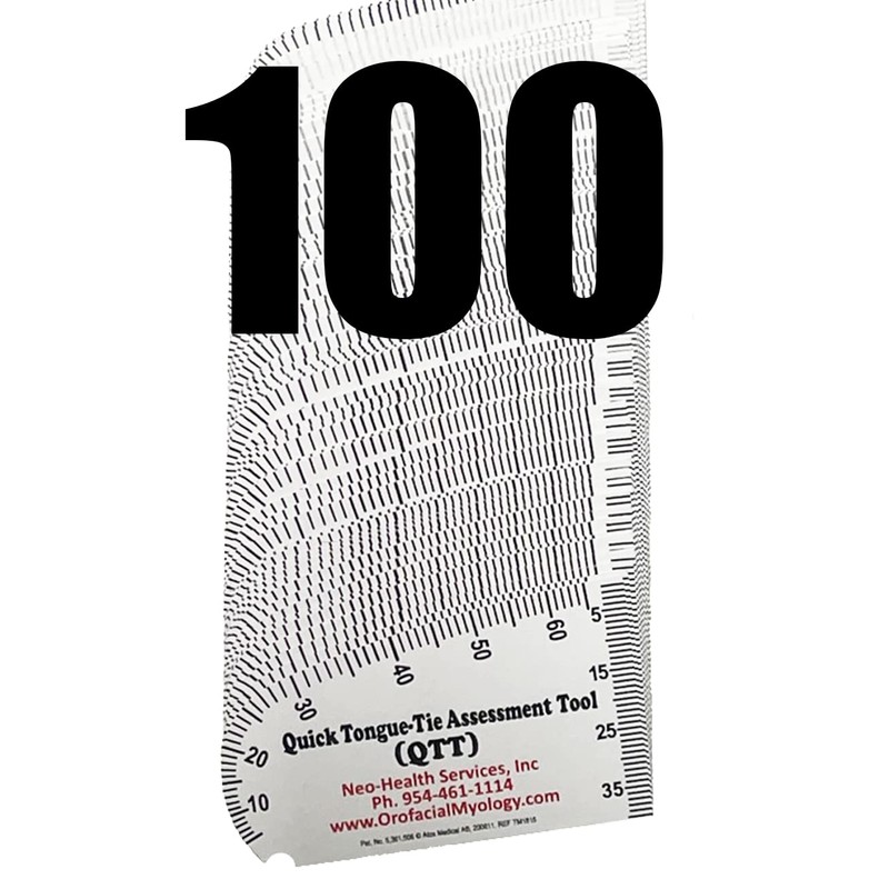 Quick Tongue-Tie Assessment