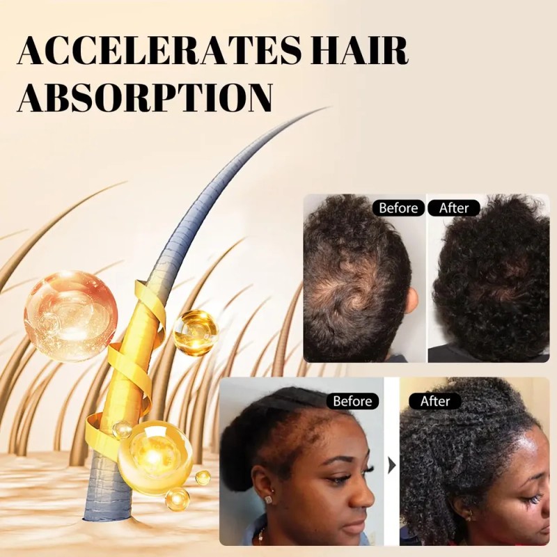 Aceite Capilar Giofna Rosemary Serum Para Cabello Encrespado