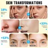 Espuma Facial Ácido Kójico Cúrcuma Control Grasa Iluminador