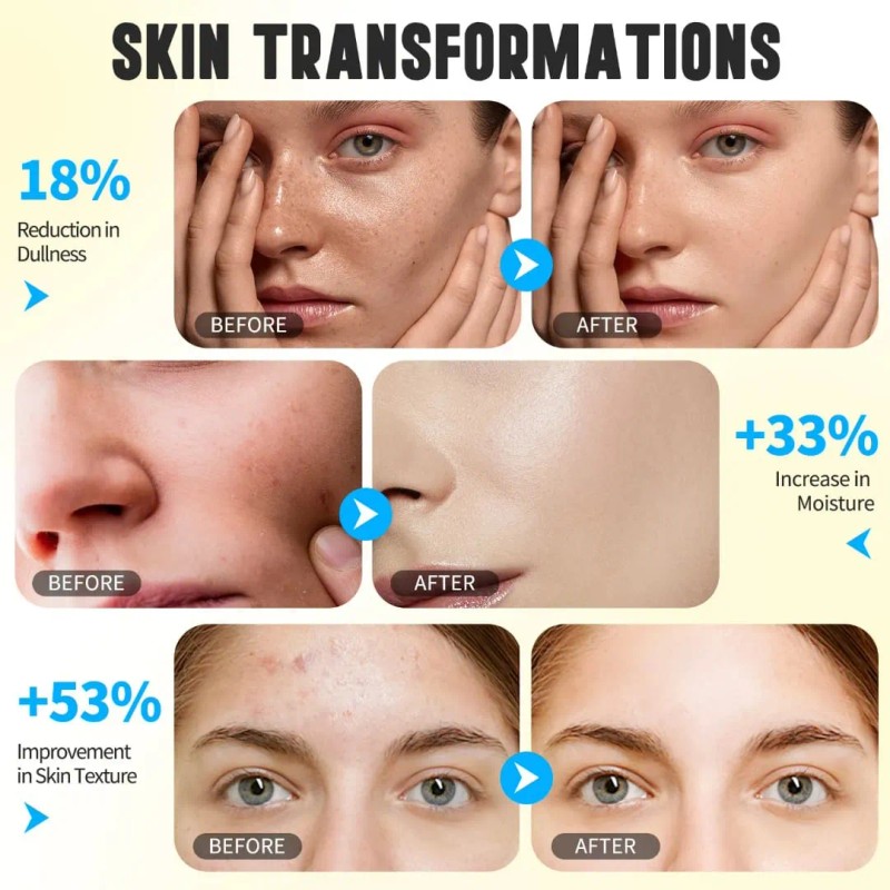 Espuma Facial Ácido Kójico Cúrcuma Control Grasa Iluminador