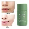 Mascarilla Facial Verde Para Limpiar La Piel Y Eliminar Los