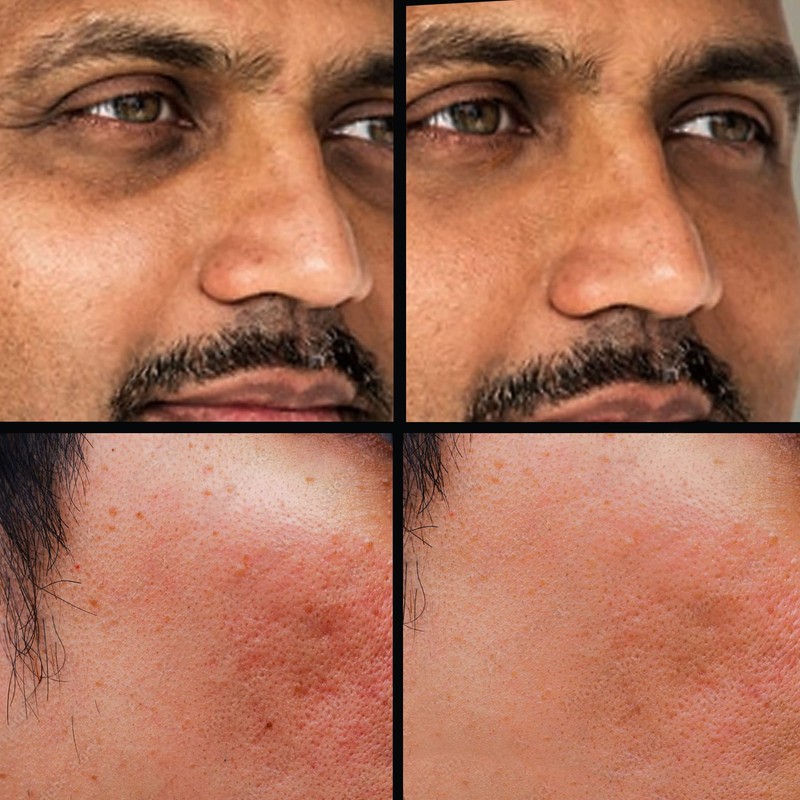 KODE Mens Concealer (Lightest) – Dark Circle Under Eye Cream