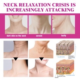 Collagen Firming Neck Cream smoothes neck lines, whitens, lifts, firms, moisturizes and nourishes the neck.