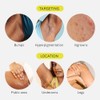 Exfoliante de seda