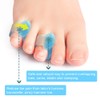 Povihome Gel Toe Separator, Pinky Toe Spacers, Little Toe Spacers