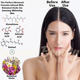 Ammuri Intense Brightening Whitening Serum Vitamin C Retinol Sale Ends 48 Hours