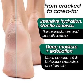 Urea 40% Crema para pies de máxima resistencia con calcetines reutilizables - Reparación intensiva de pies y tratamiento de talón agrietado - Mascaril
