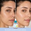 KIERO Serum Facial Niacinamida y Péptidos Essential Boost 30 ml