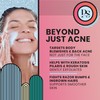 Poppin Soap Co. Salicylic Acid & Niacinamide Face, Back &