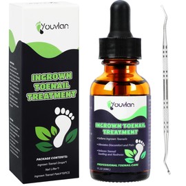 Ingrown Toenail Treatment Kit, Relieve Ingrown Toenail Pain, Repair Ingrown Toenail Issues, Safe and Convenient Home Solution