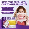 Tooth Filling Repair Kit, Temporary Tooth Filling with 5 Dental