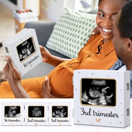 Triple Ultrasound Picture Frames, Baby Sonogram Photo Frame Pregnancy Ultrasound Keepsake Frame, Gift for Expecting Parents, Baby Shower Baby Nursery Decor, White