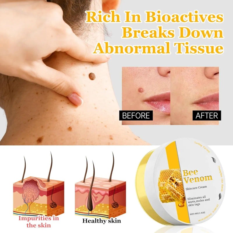 Crema De Tratamiento Para La Piel Que Reduce Las Imperfeccio