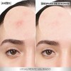 Garnier Pimple Patch Invisible, Parches Hidrocoloides Para Acné, Reduce Imperfecciones